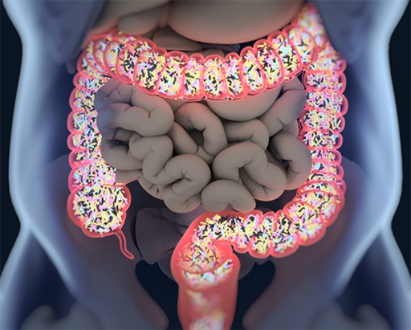 The animation picture of bowel syndrome
