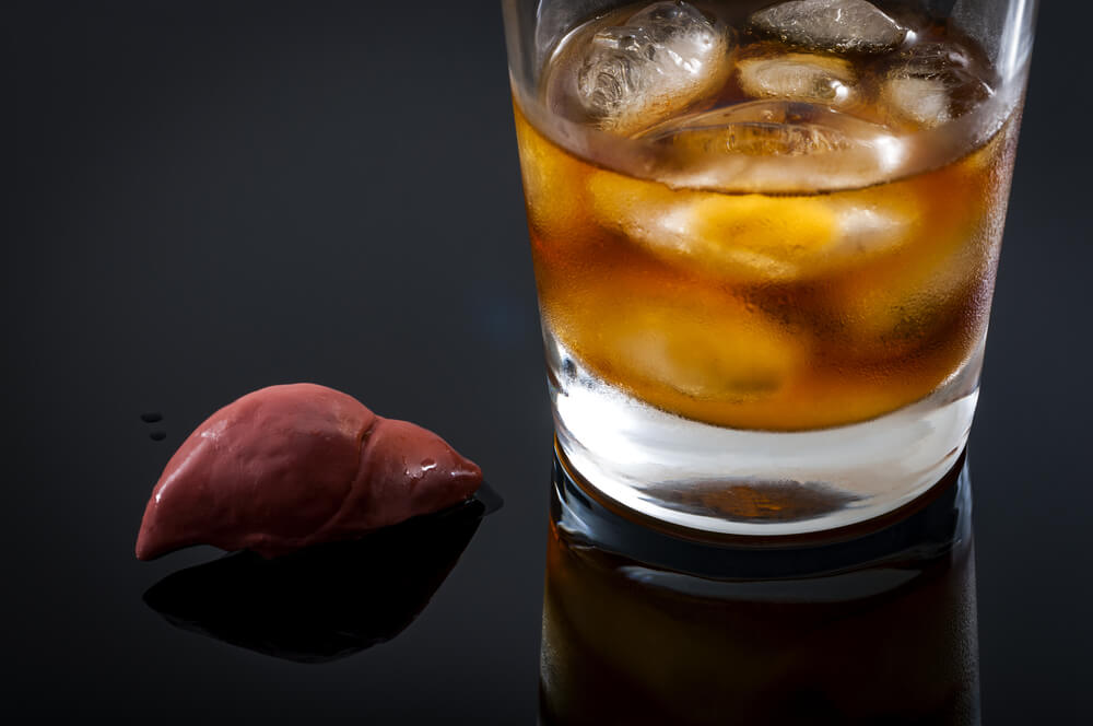 Alcohol Related Liver Disease