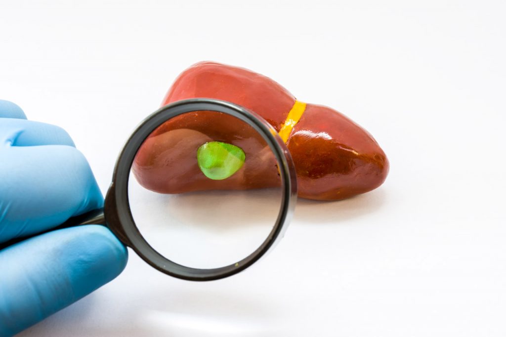 Biliary Dyskinesia Disorder Treatment at RMG in Colorado