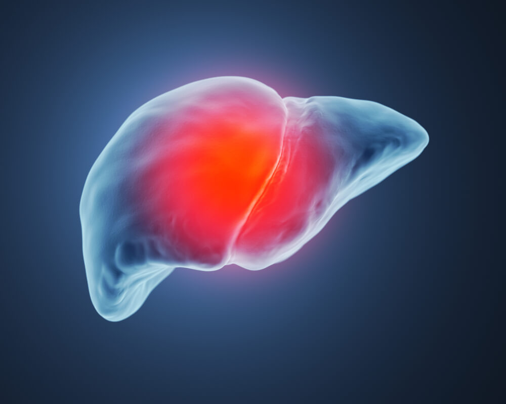 The animation of End Stage of Liver Disease (ESLD)