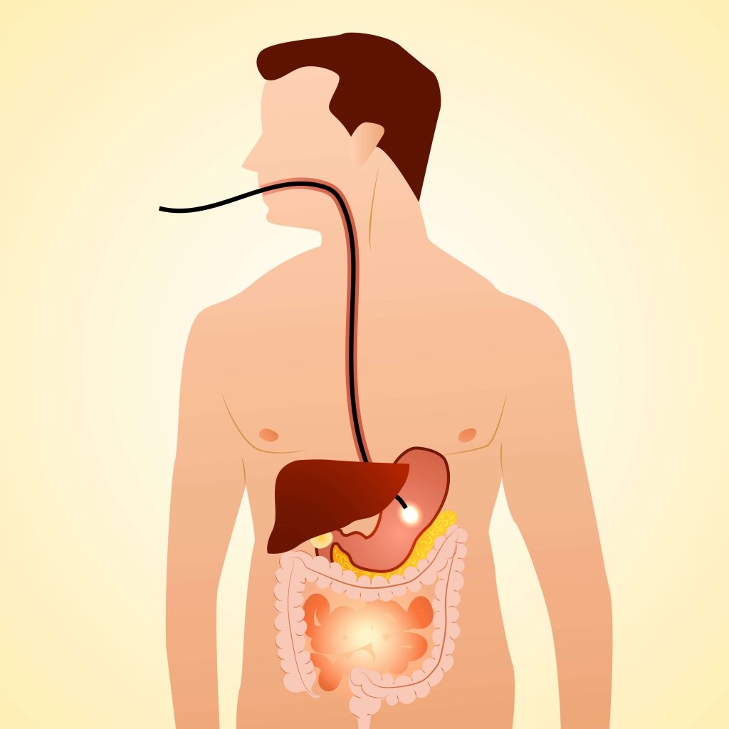 Endoscopic Retrograde Cholangiopancreatography procedures at Rocky Mountain Gastroenterology Associates