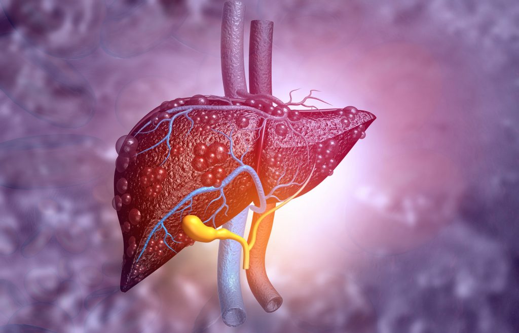 The animation of Primary Biliary Cirrhosis